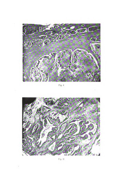 Il Cancro rivista trimestrale del centro per lo studio, diagnosi e cura dei tumori