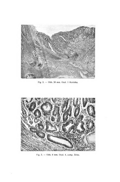 Il Cancro rivista trimestrale del centro per lo studio, diagnosi e cura dei tumori