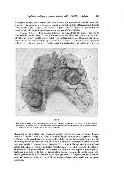 Il Cancro rivista trimestrale del centro per lo studio, diagnosi e cura dei tumori