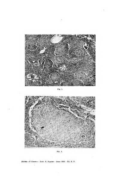 Il Cancro rivista trimestrale del centro per lo studio, diagnosi e cura dei tumori