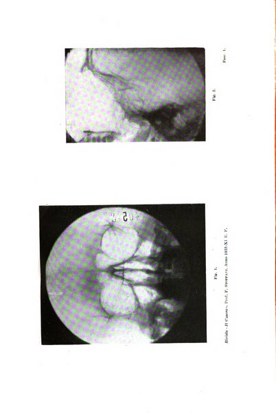 Il Cancro rivista trimestrale del centro per lo studio, diagnosi e cura dei tumori