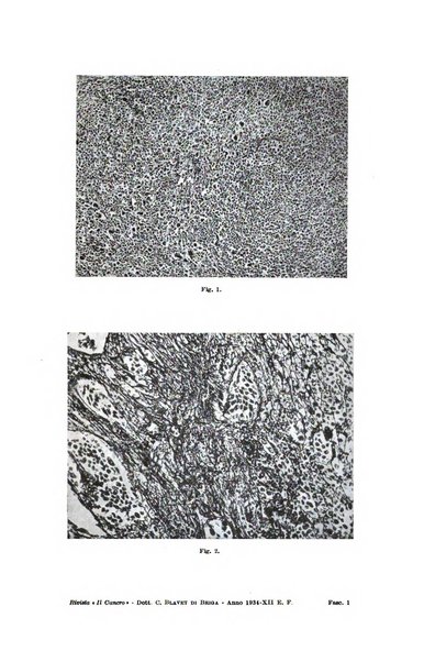 Il Cancro rivista trimestrale del centro per lo studio, diagnosi e cura dei tumori