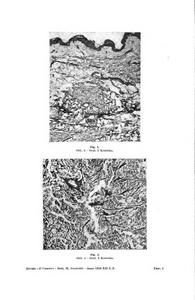 Il Cancro rivista trimestrale del centro per lo studio, diagnosi e cura dei tumori