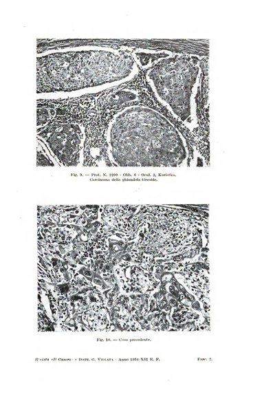 Il Cancro rivista trimestrale del centro per lo studio, diagnosi e cura dei tumori