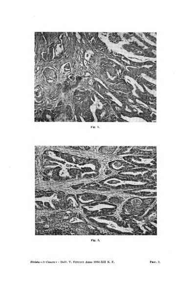 Il Cancro rivista trimestrale del centro per lo studio, diagnosi e cura dei tumori