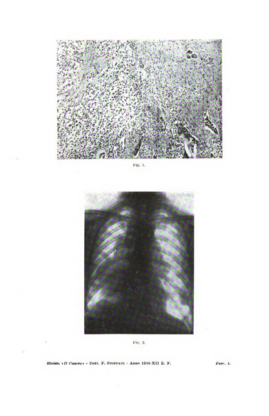 Il Cancro rivista trimestrale del centro per lo studio, diagnosi e cura dei tumori