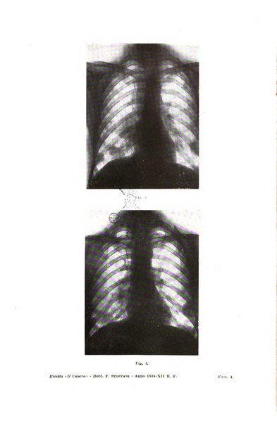 Il Cancro rivista trimestrale del centro per lo studio, diagnosi e cura dei tumori