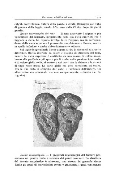 Il Cancro rivista trimestrale del centro per lo studio, diagnosi e cura dei tumori