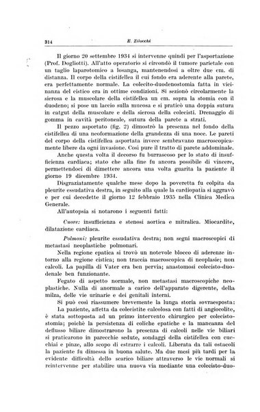 Il Cancro rivista trimestrale del centro per lo studio, diagnosi e cura dei tumori