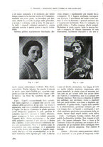 giornale/TO00181551/1937/unico/00000170