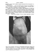 giornale/TO00181553/1913/v.3/00000096