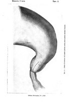 giornale/TO00181553/1914/v.2/00000085
