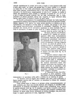 giornale/TO00181553/1919/v.2/00000310