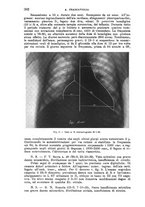 giornale/TO00181557/1940/unico/00000322