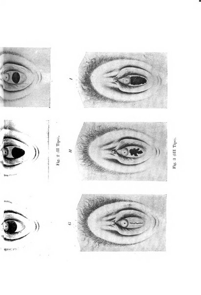 La clinica ostetrica rivista di ostetricia, ginecologia e pediatria. - A. 1, n. 1 (1899)-a. 40, n. 12 (dic. 1938)