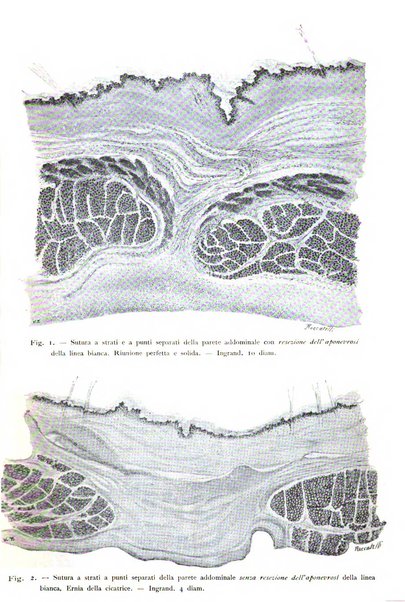 La clinica ostetrica rivista di ostetricia, ginecologia e pediatria. - A. 1, n. 1 (1899)-a. 40, n. 12 (dic. 1938)