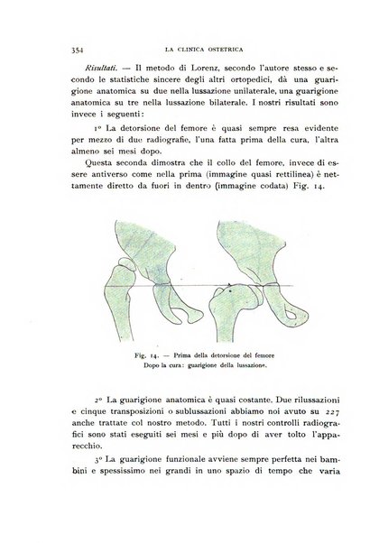 La clinica ostetrica rivista di ostetricia, ginecologia e pediatria. - A. 1, n. 1 (1899)-a. 40, n. 12 (dic. 1938)