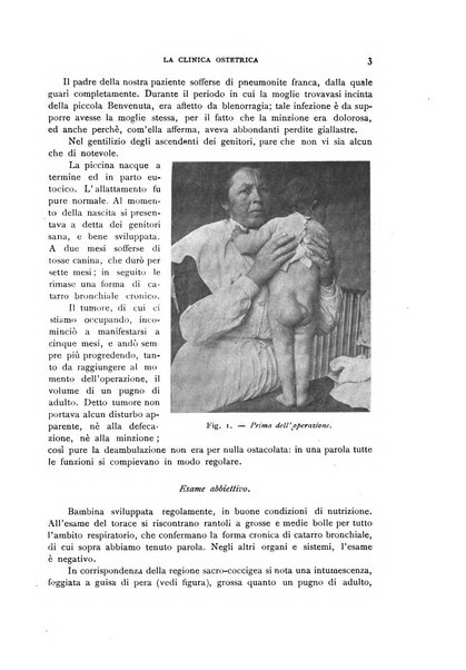 La clinica ostetrica rivista di ostetricia, ginecologia e pediatria. - A. 1, n. 1 (1899)-a. 40, n. 12 (dic. 1938)