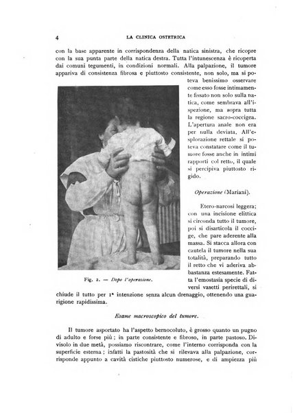 La clinica ostetrica rivista di ostetricia, ginecologia e pediatria. - A. 1, n. 1 (1899)-a. 40, n. 12 (dic. 1938)