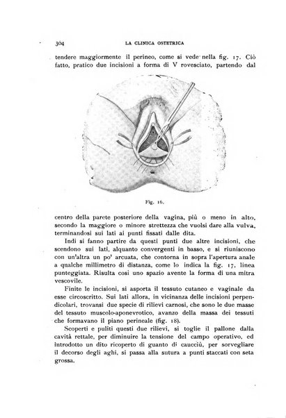 La clinica ostetrica rivista di ostetricia, ginecologia e pediatria. - A. 1, n. 1 (1899)-a. 40, n. 12 (dic. 1938)