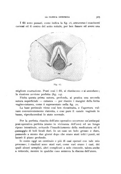 La clinica ostetrica rivista di ostetricia, ginecologia e pediatria. - A. 1, n. 1 (1899)-a. 40, n. 12 (dic. 1938)