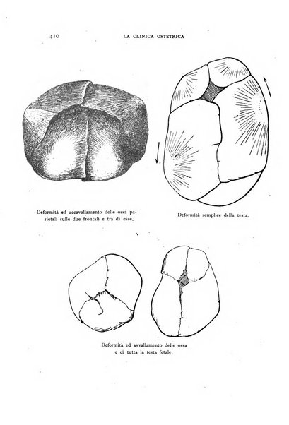 La clinica ostetrica rivista di ostetricia, ginecologia e pediatria. - A. 1, n. 1 (1899)-a. 40, n. 12 (dic. 1938)