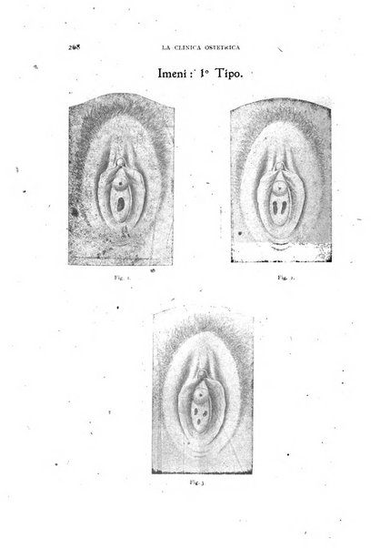 La clinica ostetrica rivista di ostetricia, ginecologia e pediatria. - A. 1, n. 1 (1899)-a. 40, n. 12 (dic. 1938)