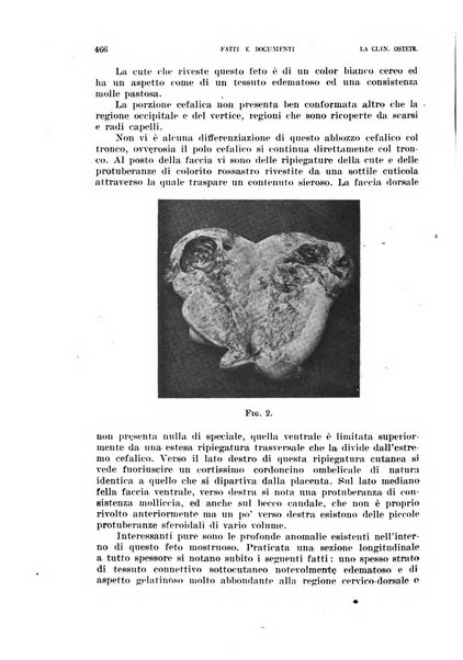 La clinica ostetrica rivista di ostetricia, ginecologia e pediatria. - A. 1, n. 1 (1899)-a. 40, n. 12 (dic. 1938)