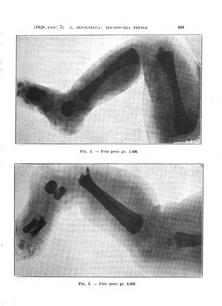 La clinica ostetrica rivista di ostetricia, ginecologia e pediatria. - A. 1, n. 1 (1899)-a. 40, n. 12 (dic. 1938)