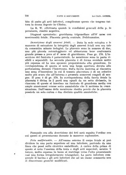 La clinica ostetrica rivista di ostetricia, ginecologia e pediatria. - A. 1, n. 1 (1899)-a. 40, n. 12 (dic. 1938)