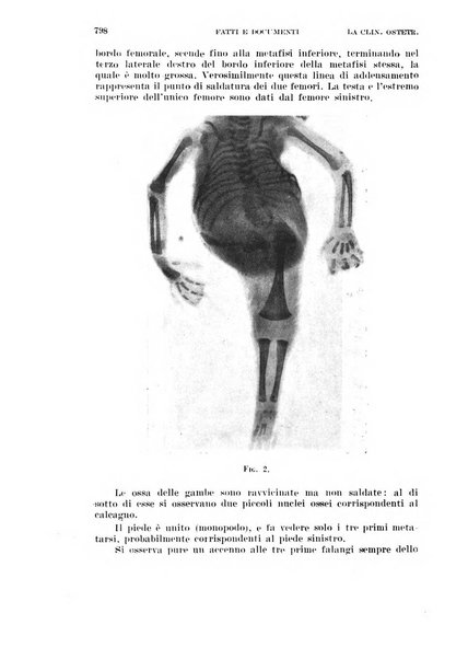 La clinica ostetrica rivista di ostetricia, ginecologia e pediatria. - A. 1, n. 1 (1899)-a. 40, n. 12 (dic. 1938)