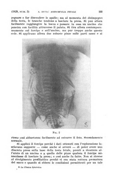 La clinica ostetrica rivista di ostetricia, ginecologia e pediatria. - A. 1, n. 1 (1899)-a. 40, n. 12 (dic. 1938)