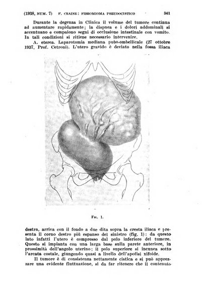 La clinica ostetrica rivista di ostetricia, ginecologia e pediatria. - A. 1, n. 1 (1899)-a. 40, n. 12 (dic. 1938)