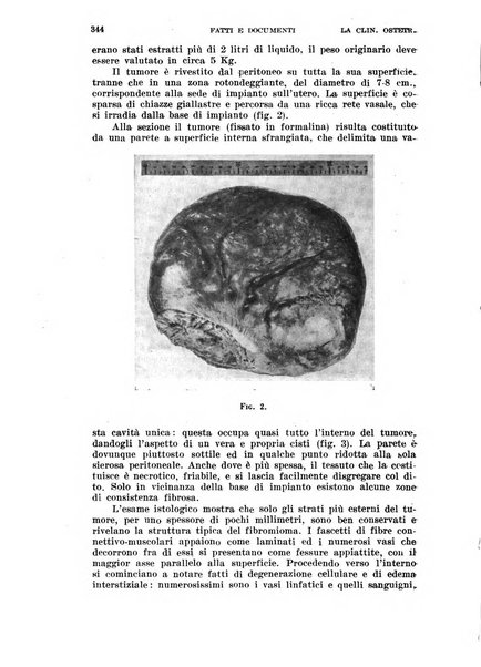 La clinica ostetrica rivista di ostetricia, ginecologia e pediatria. - A. 1, n. 1 (1899)-a. 40, n. 12 (dic. 1938)