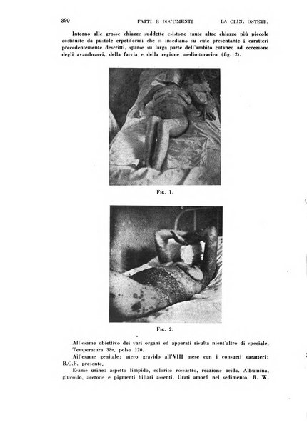 La clinica ostetrica rivista di ostetricia, ginecologia e pediatria. - A. 1, n. 1 (1899)-a. 40, n. 12 (dic. 1938)