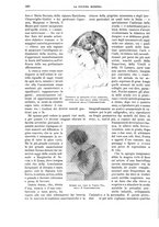 giornale/TO00182518/1914/unico/00000424