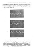 giornale/TO00182537/1938/unico/00000087