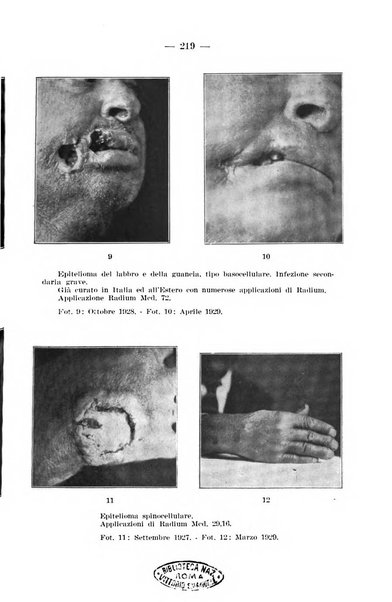 Il dermosifilografo gazzetta di dermosifilografia per il medico pratico