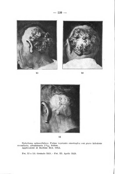 Il dermosifilografo gazzetta di dermosifilografia per il medico pratico