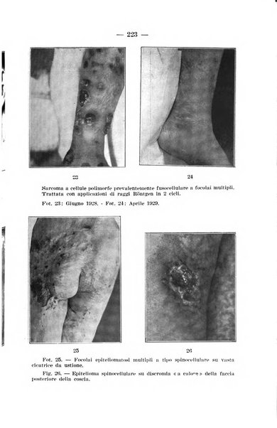 Il dermosifilografo gazzetta di dermosifilografia per il medico pratico