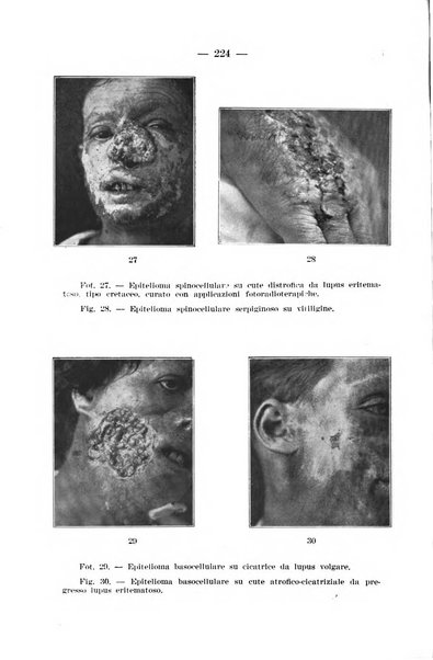 Il dermosifilografo gazzetta di dermosifilografia per il medico pratico