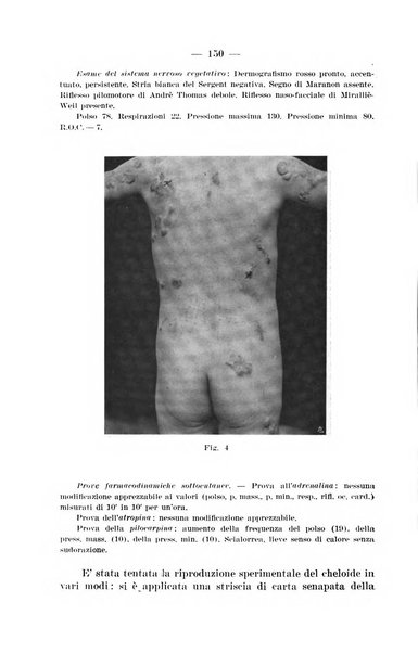 Il dermosifilografo gazzetta di dermosifilografia per il medico pratico