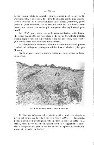 Il dermosifilografo gazzetta di dermosifilografia per il medico pratico