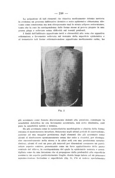 Il dermosifilografo gazzetta di dermosifilografia per il medico pratico