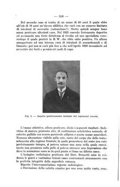 Il dermosifilografo gazzetta di dermosifilografia per il medico pratico