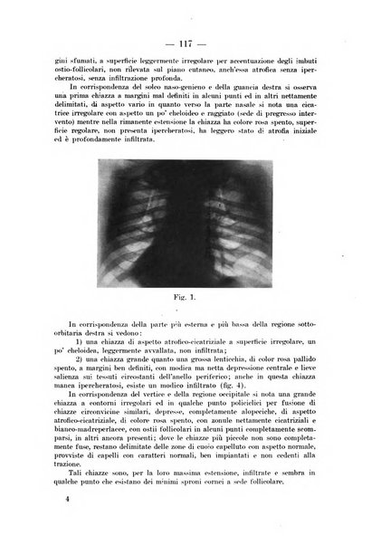 Il dermosifilografo gazzetta di dermosifilografia per il medico pratico