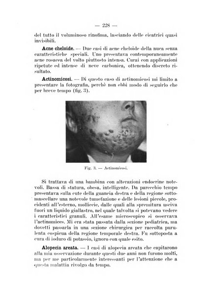 Il dermosifilografo gazzetta di dermosifilografia per il medico pratico