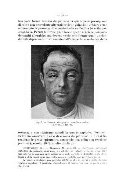 Il dermosifilografo gazzetta di dermosifilografia per il medico pratico