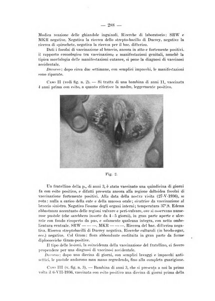 Il dermosifilografo gazzetta di dermosifilografia per il medico pratico