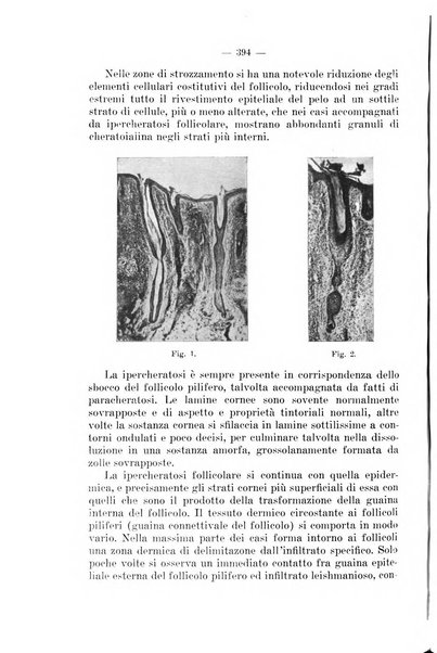 Il dermosifilografo gazzetta di dermosifilografia per il medico pratico